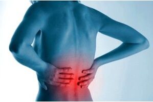 Miesto osteochondrózy chrbtice